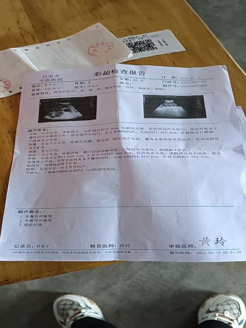 李灵奶奶B超报告 李灵奶奶B超报告